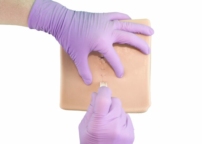 Skin Patches (Package of 10)