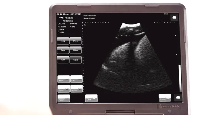 Chest Drain & Needle Decompression Trainer - Image 9