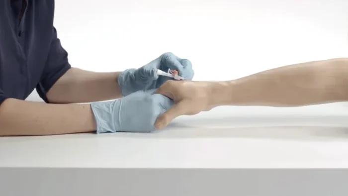 Standard Venipuncture Arm - Image 3
